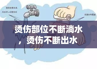 烫伤部位不断淌水，烫伤不断出水 