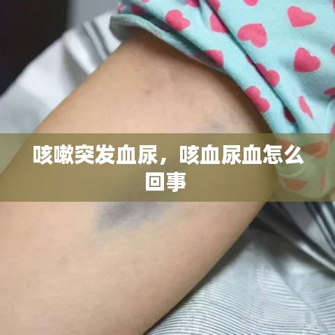 咳嗽突发血尿，咳血尿血怎么回事 