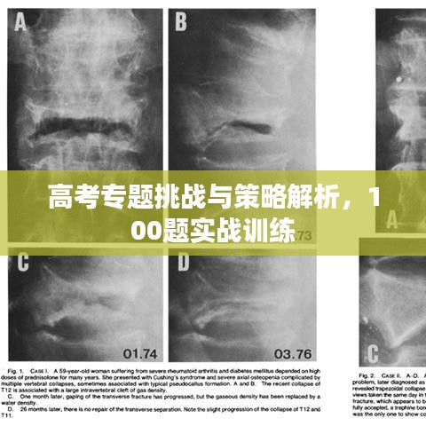 高考专题挑战与策略解析，100题实战训练