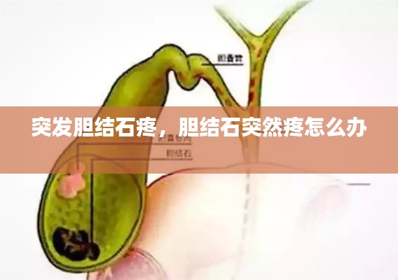 突发胆结石疼，胆结石突然疼怎么办 