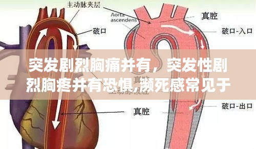 突发剧烈胸痛并有，突发性剧烈胸疼并有恐惧,濒死感常见于 