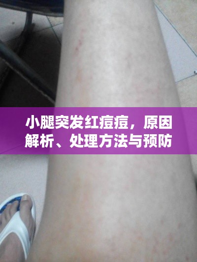 小腿突发红痘痘，原因解析、处理方法与预防策略